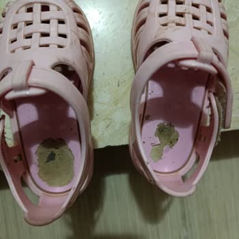 Bebek Sandaletinde Kısa Sürede Soyulma Ve Hayal Kırıklığı