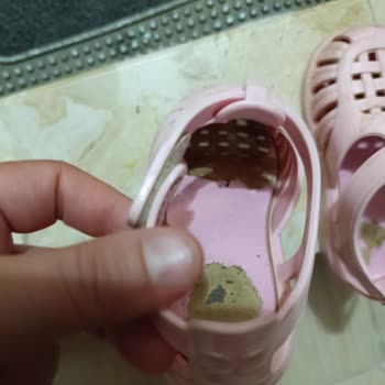 Bebek Sandaletinde Kısa Sürede Soyulma Ve Hayal Kırıklığı