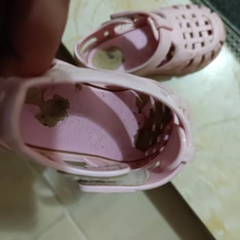 Bebek Sandaletinde Kısa Sürede Soyulma Ve Hayal Kırıklığı