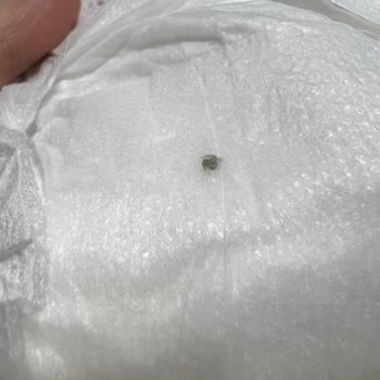 Bebek Bezinde Bilinmeyen Cisimle Karşılaştım, İnceleme Ve Ürün Değişimi Talep Ediyorum