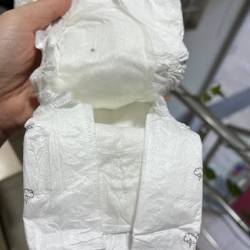 Bebek Bezinde Bilinmeyen Cisimle Karşılaştım, İnceleme Ve Ürün Değişimi Talep Ediyorum