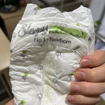 Bebek Bezinde Bilinmeyen Cisimle Karşılaştım, İnceleme Ve Ürün Değişimi Talep Ediyorum