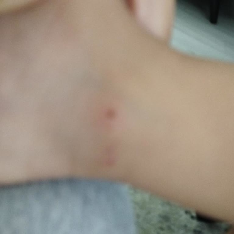 Bebek Sandaleti Ayağı Yaraladı, Değişim Talebim Reddedildi