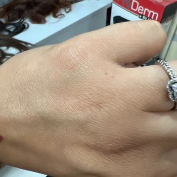 Otel Konaklamasında Güvenlik Ve Hizmet Sorunları Yaşadım