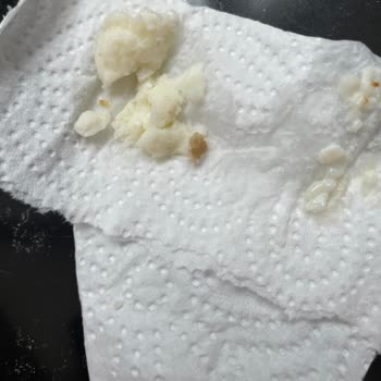 Peynirin İçinden Yabancı Madde Çıktı: Açıklama Ve İade Talebim Var