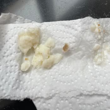 Peynirin İçinden Yabancı Madde Çıktı: Açıklama Ve İade Talebim Var