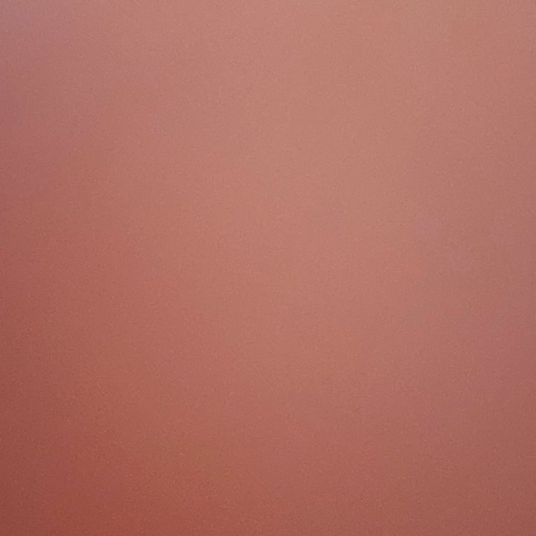 ATM'ye Yatırdığım 21.000 TL Hesabıma Geçmedi, Mağduriyetim Giderilmiyor