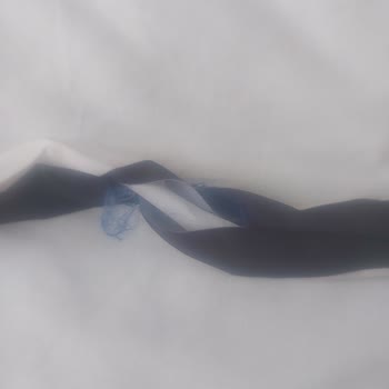 Kampanyalı Elbise Kalitesiz Çıktı, İade Ve İletişimde Mağdur Edildim