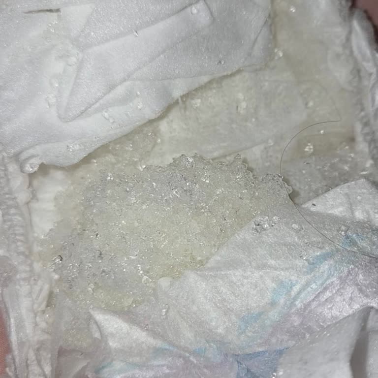 Molfix Bebek Bezinde Petek Patlaması Ve Ciltte Kızarıklık Endişesi