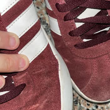 Kısa Sürede Deforme Olan Ayakkabıya Çözüm Bulunmuyor