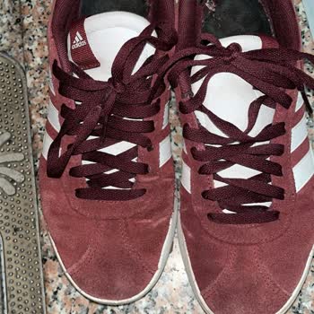 Kısa Sürede Deforme Olan Ayakkabıya Çözüm Bulunmuyor