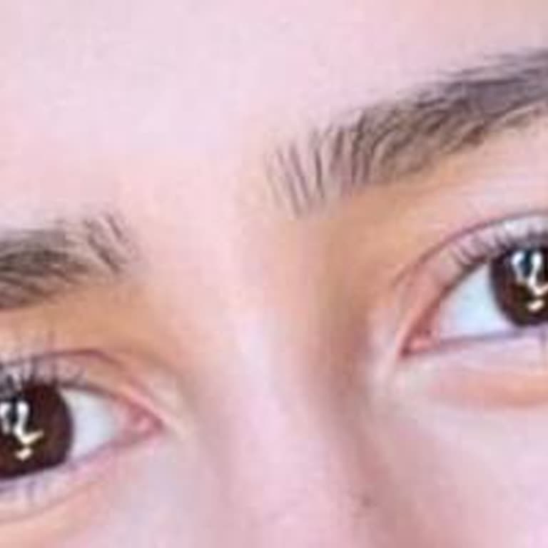 Kirpik Lifting Ve Epilasyon Hizmetinde Memnuniyetsizlik, Ücret İadesi Talebi