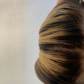 Ombre Sonrası Saçta Renk Bozukluğu Ve Faturasız İşlem Mağduriyeti