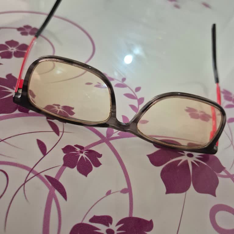 Satın Aldığım Gözlükte Garanti Süresi Sonrası Sararma Problemi