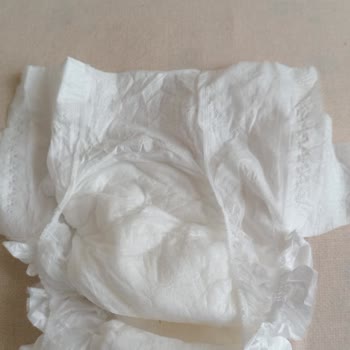 Sleepy Bebek Bezinde Üretim Hatası Ve Müşteri Hizmetlerinde Yaşanan Sorunlar