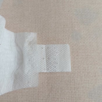 Sleepy Bebek Bezinde Üretim Hatası Ve Müşteri Hizmetlerinde Yaşanan Sorunlar