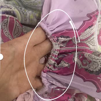 Kusurlu Elbise, İlgisiz Müşteri Hizmeti Ve İade Sürecinde Büyük Mağduriyet