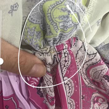 Kusurlu Elbise, İlgisiz Müşteri Hizmeti Ve İade Sürecinde Büyük Mağduriyet