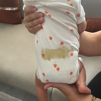 Molfix Bir Numara Bebek Bezinde Sürekli Sızma Sorunu Yaşıyoruz