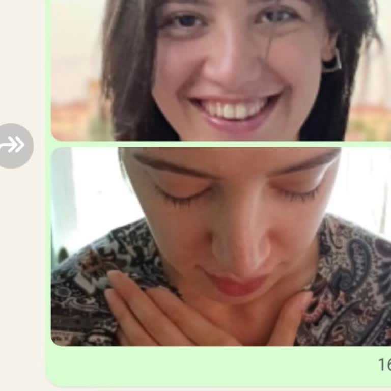 Burun Ameliyatı Sonrası Oluşan Yamukluk Ve İkinci Ameliyat Talebi