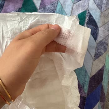 Aldığım Bebek Bezi Paketinde Eksik Ve Sorunlu Ürün Çıktı