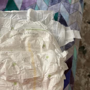 Aldığım Bebek Bezi Paketinde Eksik Ve Sorunlu Ürün Çıktı