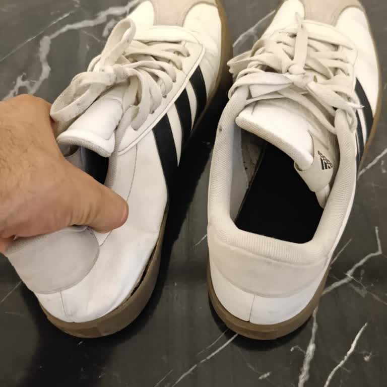 Kısa Sürede Deforme Olan Ayakkabıya Olumsuz Garanti Yanıtı