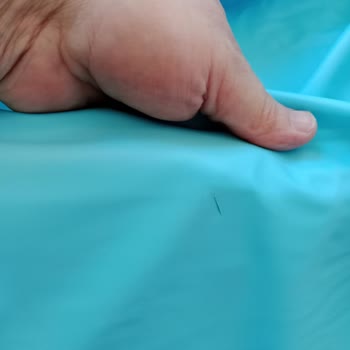 Aldığım Üründe Kesikler Çıktı İade Talebim Reddedildi