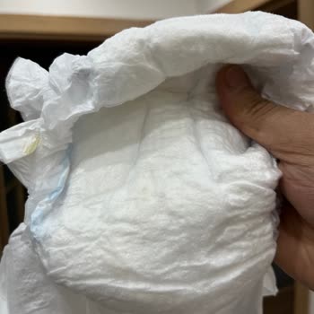 Bebek Bezinde Lekeler Hijyen Endişesi Yaşadım