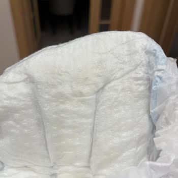 Bebek Bezinde Lekeler Hijyen Endişesi Yaşadım