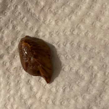 Çikolatadan Çıkan Büyük Badem Kabuğu Sağlık Riski Oluşturdu