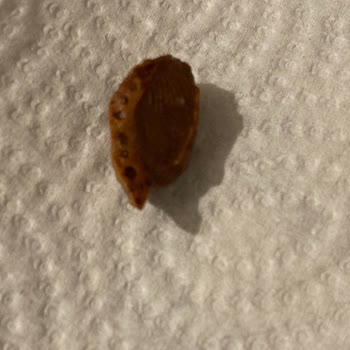 Çikolatadan Çıkan Büyük Badem Kabuğu Sağlık Riski Oluşturdu