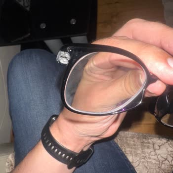 Gözlükte Tekrarlayan Vida Sorunu Ve Garanti Sürecinde Mağduriyet