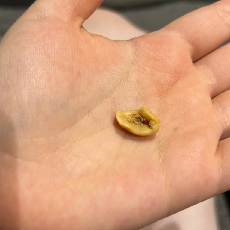 Aldığım Kuruyemişin İçinden Böcek Çıktı, Misafirime Mahcup Oldum