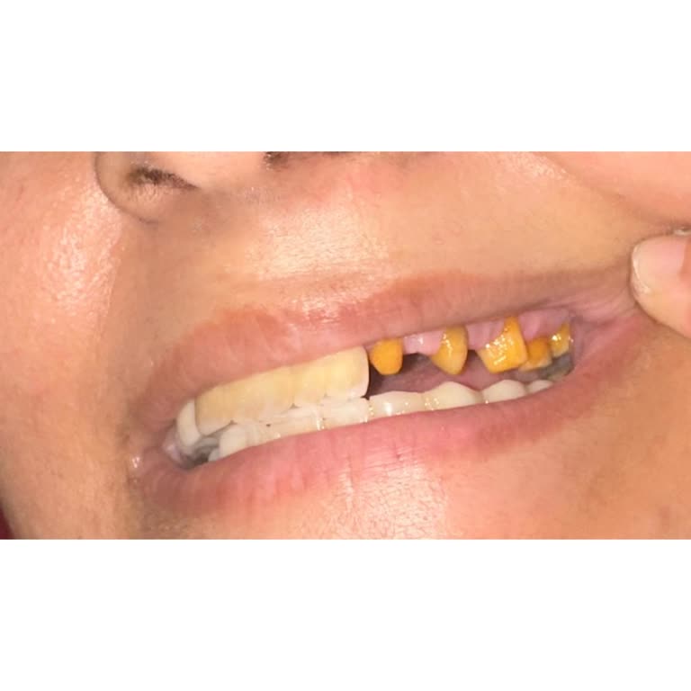 Platinum Ağız Diş Kliniği'nde Tedavi Sürecinde Mağduriyet Ve İlgisizlik