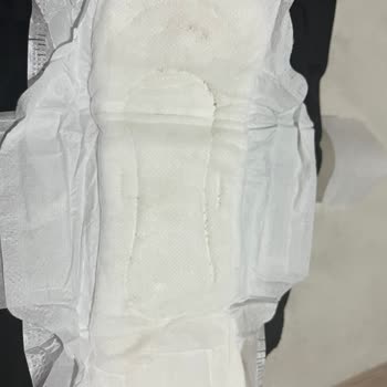 Açılmamış Pedlerde Sarı Lekeler Ve Kararmalar Şok Etti