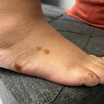 Polaris Sandalet Ayağımda Pas Lekesi Yaptı, İade Talebim Reddedildi