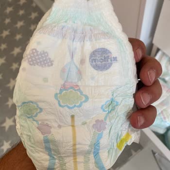 Molfix Külot Bez Bebeğimde Alerjiye Sebep Oldu