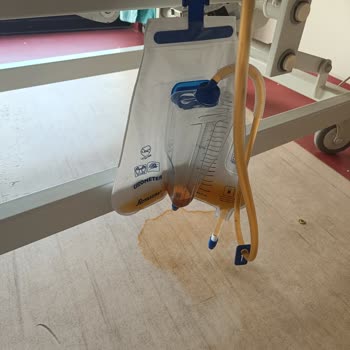 Mardin Araştırma Hastanesi Hijyen Eksikliği Ve Personel İlgisizliği Enfeksiyon Riskini Artırıyor