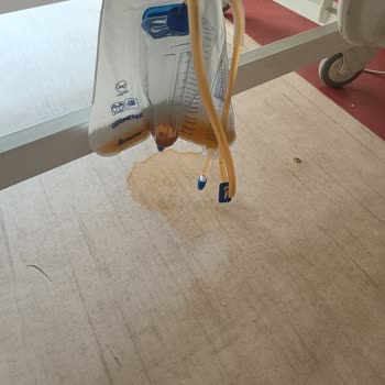 Mardin Araştırma Hastanesi Hijyen Eksikliği Ve Personel İlgisizliği Enfeksiyon Riskini Artırıyor