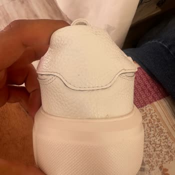 Yanlış Ve Defolu Ürün Teslimatı Sonrası Sürekli Mağduriyet