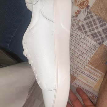 Yanlış Ve Defolu Ürün Teslimatı Sonrası Sürekli Mağduriyet