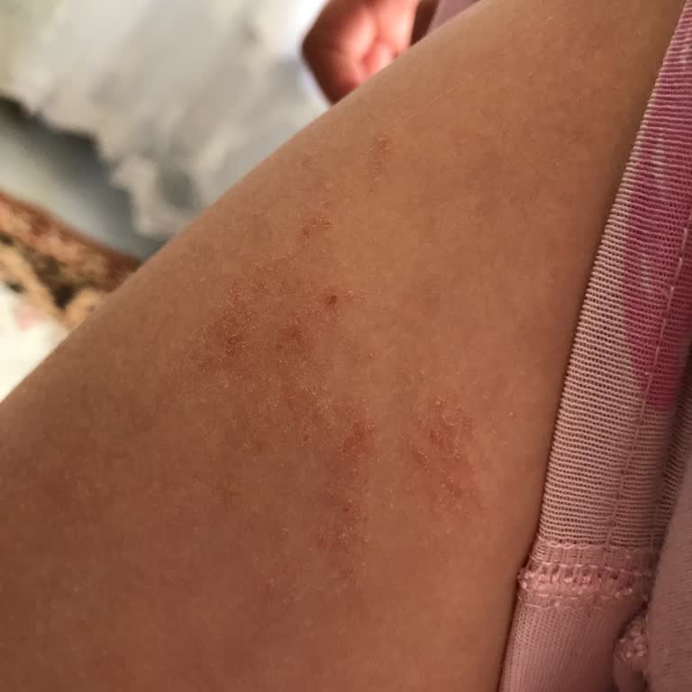 Bingo Toz Deterjanın Kokusuz Çıkması Ve Çocukta Alerji Yapması Endişe Yarattı