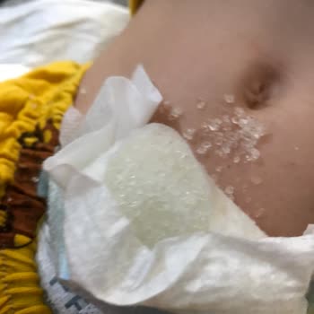 Molfix Bebek Bezi Sızdırma Ve Pişik Sorunu: Hayal Kırıklığı