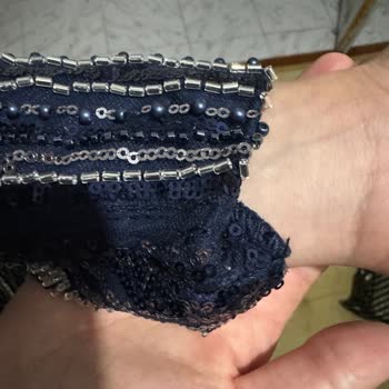 Aldığım Abiyede Onarımdan Sonra Büyük Hatalar Ve İade Talebim