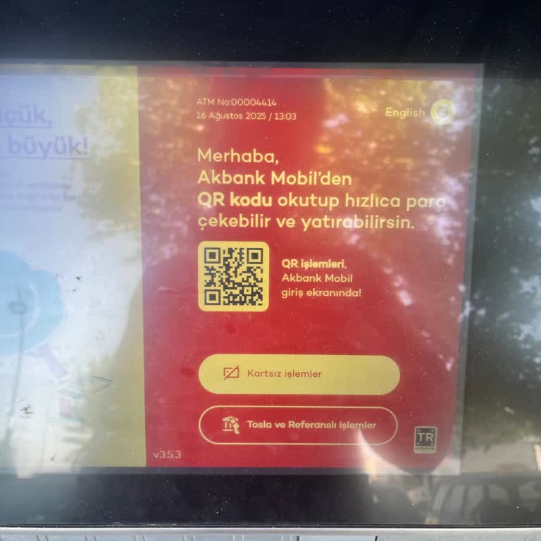 ATM'den Yatırılan Para Hesabıma Geçmedi, Müşteri Temsilcisi İlgilenmiyor