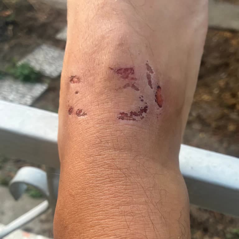 Yeni Alınan Terlik İlk Günde Ayakta Ciddi Yara Yaptı Değişim Reddedildi