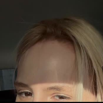 Saç Boyama Sonrası Turuncu Renk Ve Yetersiz İlgilenme