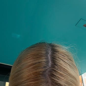 Saç Boyama Sonrası Turuncu Renk Ve Yetersiz İlgilenme