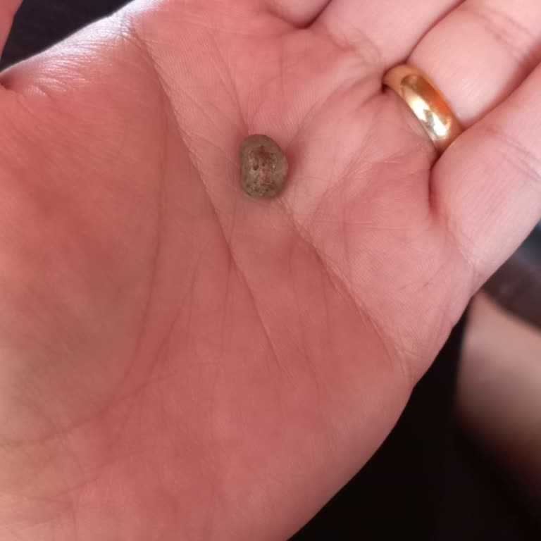 Aldığım Helvanın İçinden Taş Çıktı, Dişim Kırıldı